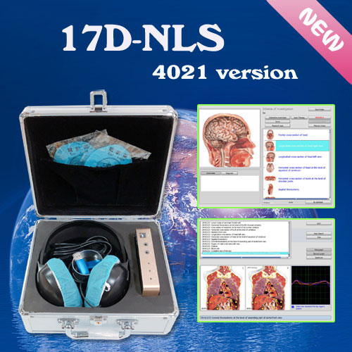Diagnosis Knee Joints By 17D-NLS