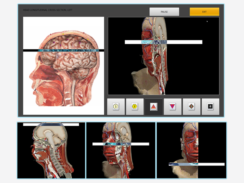 Biophilia Tracker NLS-method Can Help Colonic Neoplasm Diagnostic